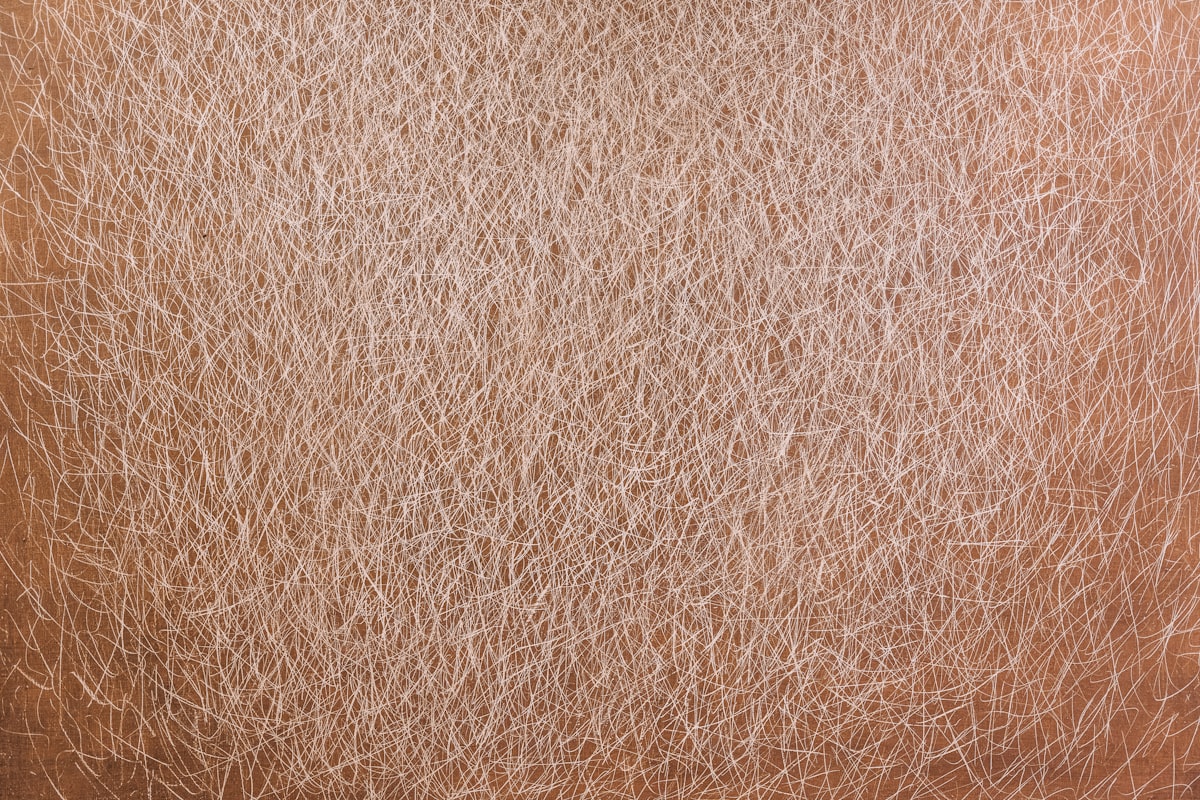 Starostlivosť o kožu pri atopickej dermatitíde